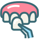 اصلاح طرح لبخند